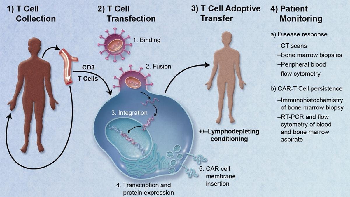 Car T Cell Therapy